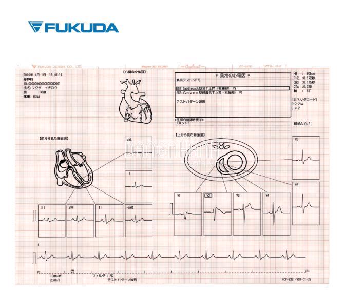 Máy điện tim 12 kênh FX-8322